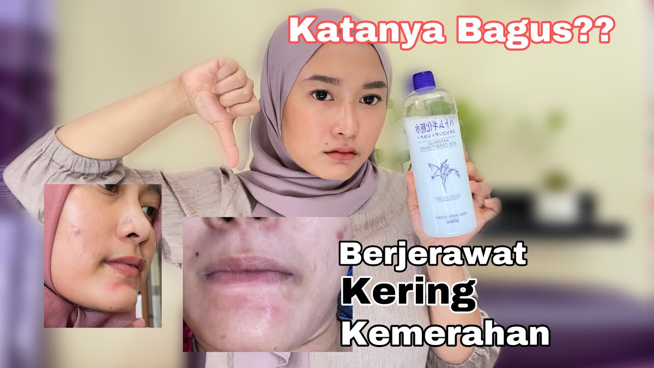 Review Hatomugi Skin Conditioner Bagus Untuk Jerawat??? Tapi Malah