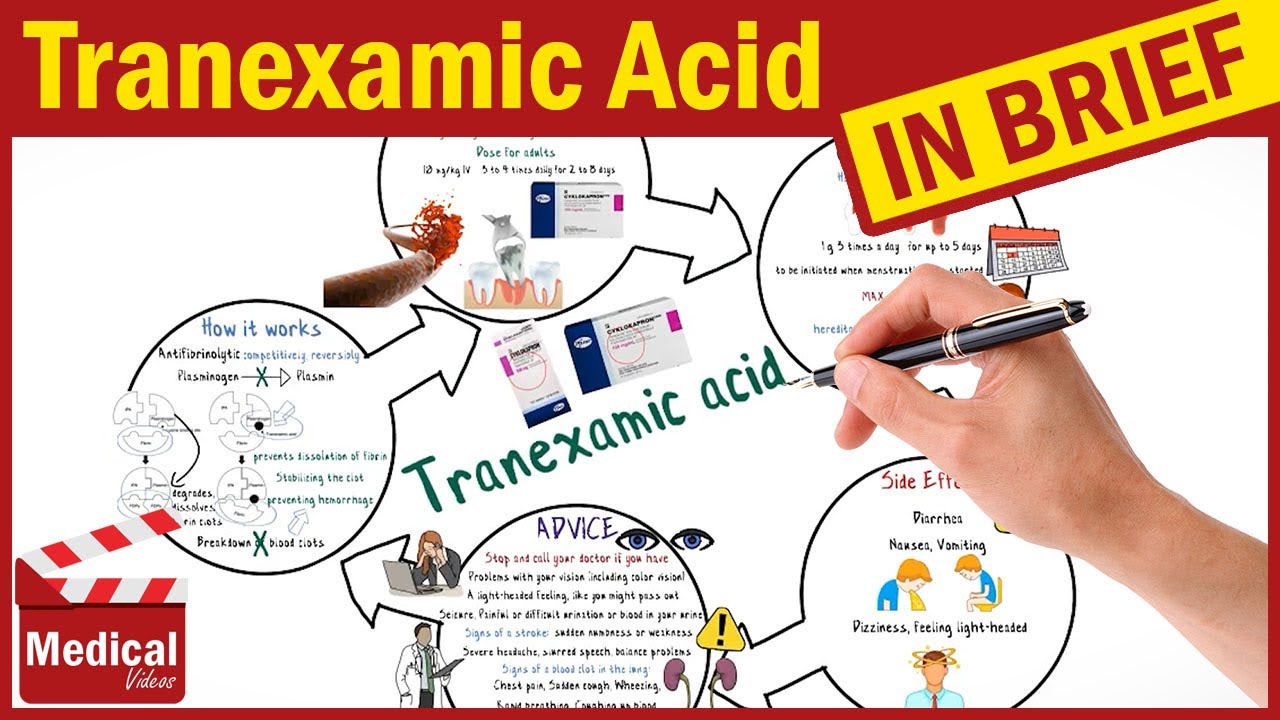 Tranexamic Acid (Cyklokapron): What is Tranexamic Acid? Action, Uses, Dose and Side Effects