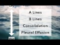 Lung Ultrasound and COVID19