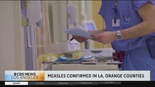 More measles cases reported in Los Angeles, Orange counties