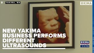 Yakima Good: Sneak Peak Ultrasounds