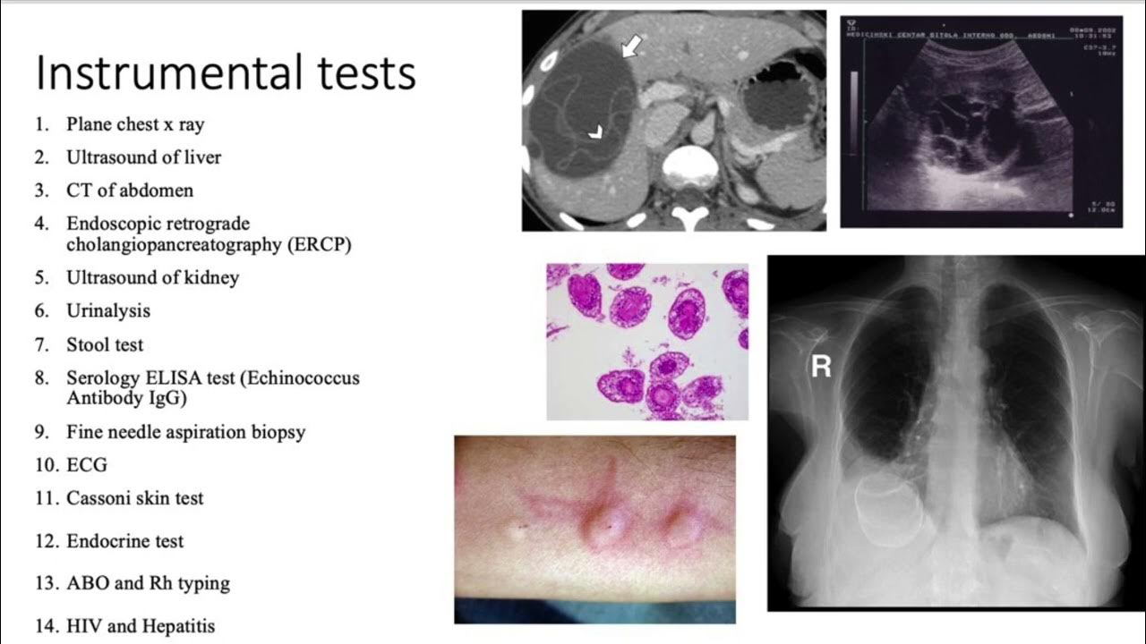 Laboratory and Instrumental Diagnosis (Parasitic Infection) Tan JoE