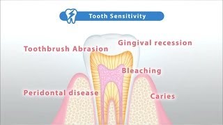 Relieve tooth sensitivity with Teethmate Desensitizer: Creating Hydroxyapatite (HAp)