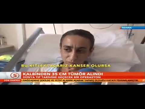 Samanyolu Haber - Adana'da Esma Yüksel’in Kalbinden 35 cm'lik Tümor Çıkarıldı