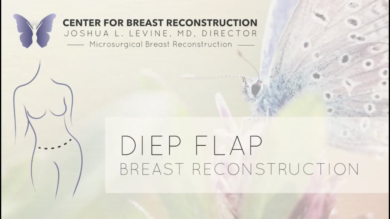 How to Fix Tuberous Breasts  Autologous Breast Reconstruction
