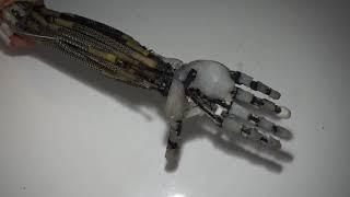 Artificial Muscles Robotic Arm, Real Copy of Human Arm screenshot 5