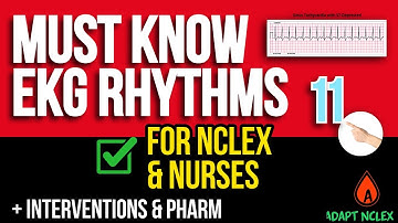 NCLEX Cardiac Review: Must-Know EKG Rhythms & ECG Interpretation for Nurses