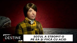 DESTINE: Soțul a stropit-o pe ea și fiică cu acid. “A vrut să mă omoare”