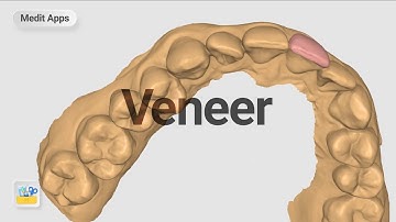 Designing a Veneer with Medit Design App