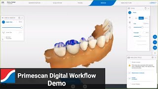 Primescan Digital Workflow and Software Demo screenshot 3