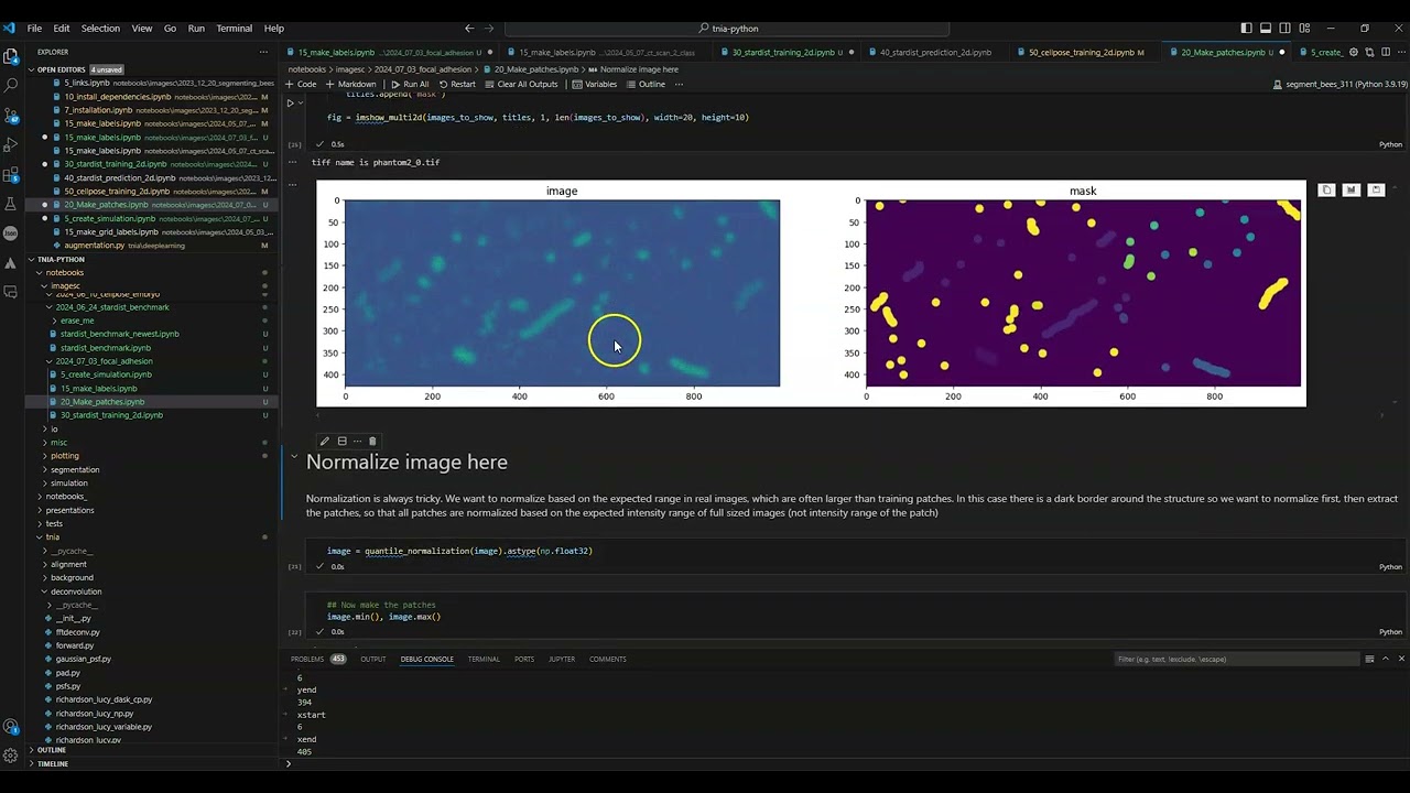 Exploring Stardist scale and shape