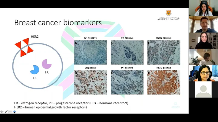 Dr  Nancy Nixon Diagnosis of MBC and Subtypes