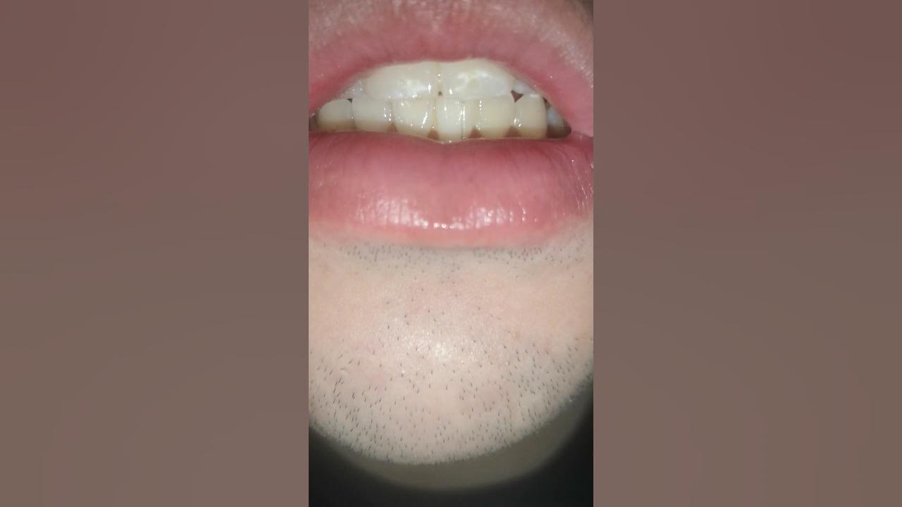 Uvula boy YouTube