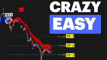 I Spent Months Failing in Trading… Until I Realized This One Thing 💡