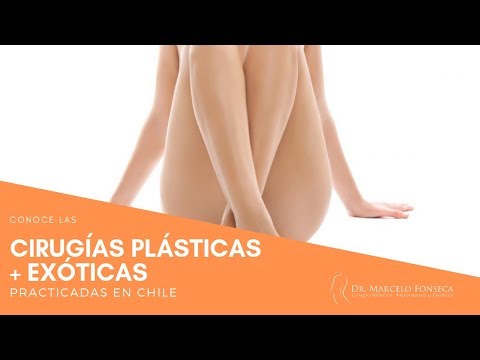 Conoce las cirugías plásticas más exóticas practicadas en Chile 