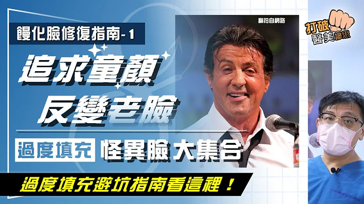 微整填充劑別再拚命往臉上補　玻尿酸補蘋果肌/下巴微整形/豐頰豐額   沒變年輕反成黑山老妖怪！　過度填充怪臉大集合 打破醫美謬思 236-20211130 - 天天要聞