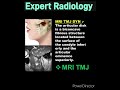 MRI TMJ Dynamic Radiology - Naresh gehlot #mri #medicalimaging