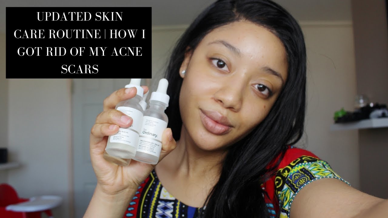 Updated Skin Care Routine | How I Got Rid Of My Acne Scars | The ...