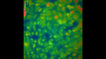 Case study 1. Application Note: Fura-2 Imaging with the X-Cite NOVEM