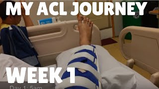 My ACL Surgery Journey Week 1