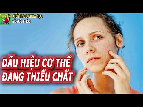 Video: Làm thế nào để biết bạn có bị thiếu hụt vitamin hay không