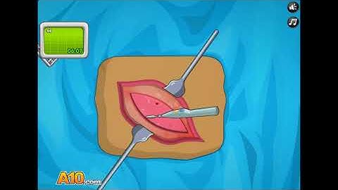 Operate Now!: Appendix Surgery. Mual... Mual Gw (Review)