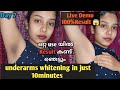 Live Result കണ്ട് ഞെട്ടാൻ ready ആണോ 😱Underarms whitening at home in just 10 minutes//live demo