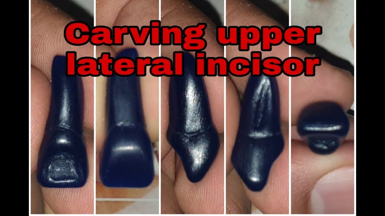 Carving upper lateral incisor (بدون حذف مقاطع التسييح) YouTube