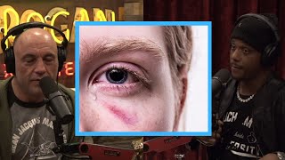 This Sport Has A Huge Problem with Eye Injuries by JRE-Daily-Updates 5,249 views 1 year ago 7 minutes, 59 seconds