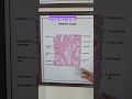 Prostate Histology  by Shishir