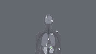 How can TCE exposure affect adults and children - Kidney