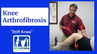 How to Treat an Arthrofibrotic Knee in Physical Therapy screenshot 3
