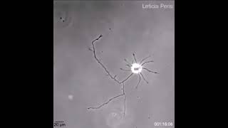 A Lone Brain Cell Reaching Out For Connections