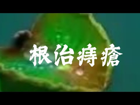 D298  氣虛型痔瘡根治八卦配方分享