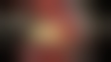 End-to-End Microanastomosis – Interrupted Suture Technique