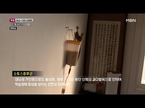 소토스 증후군을 가지고 태어난 아들 MBN 210213 방송