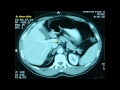 Cross sectional and imaging anatomy of the abdomen