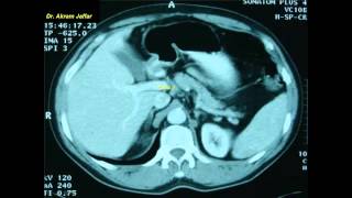 Cross sectional and imaging anatomy of the abdomen