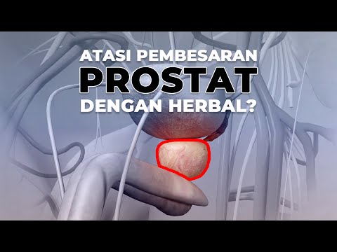 Video: Adakah reseksi transuretra prostat berkesan?