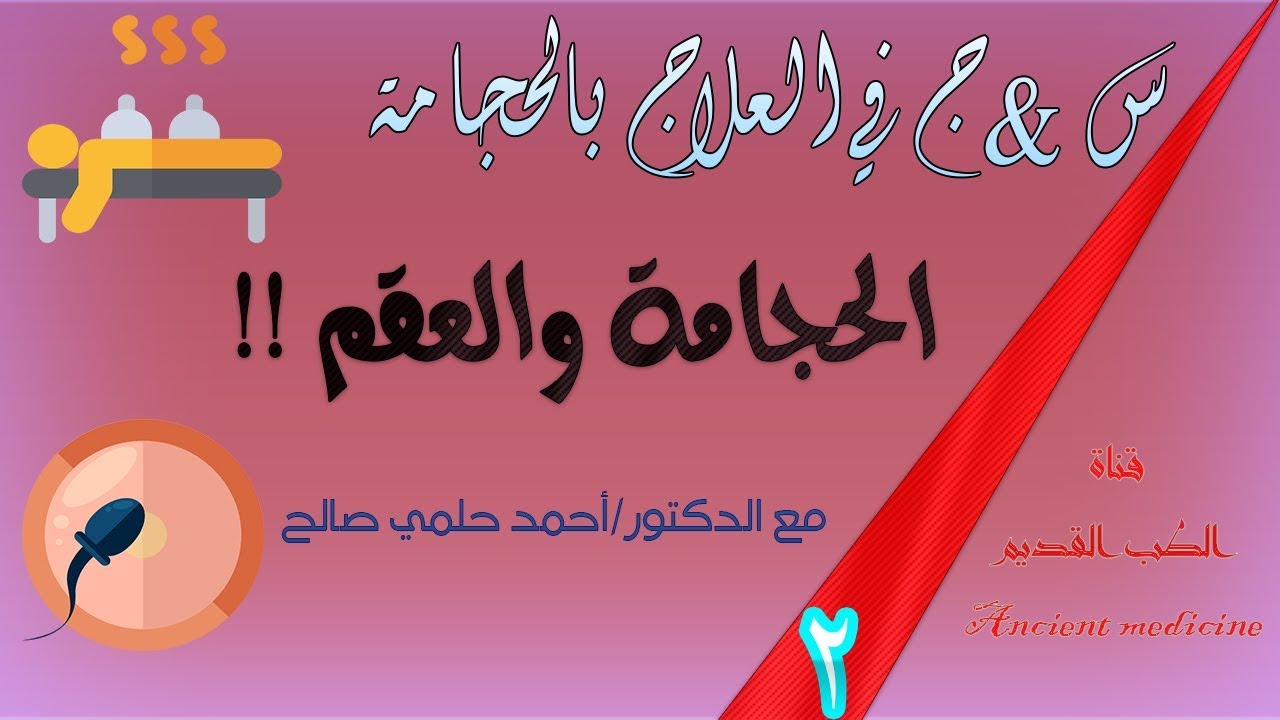 الحجامة | س&ج | ( س2) | الحجامة والعقم !!