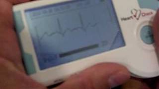 ElectroCardioGraphy (ECG) data to be communicated via WiFi with a remote server