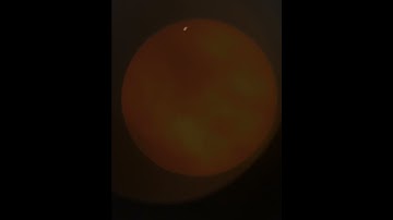 I Pointed My Telescope At Mars