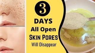 3 Days and All Open Pores Will Disappear from Your Skin Forever screenshot 3