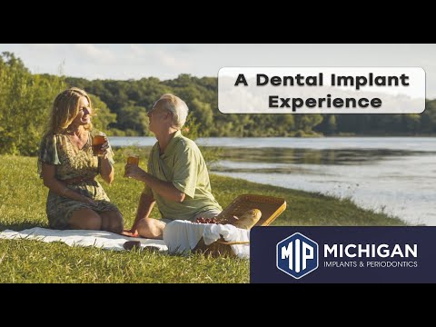 The Dental Implant Experience!