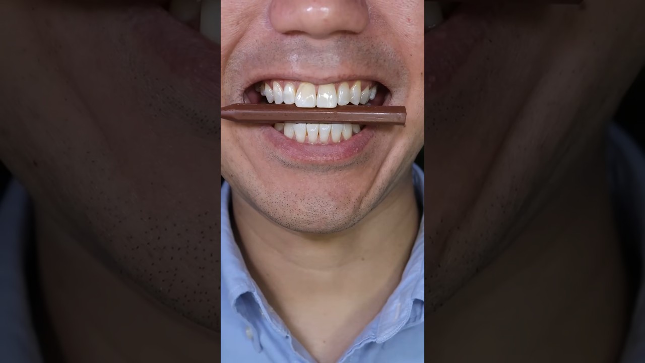 Nobel Super Soda Candy ASMR#shots