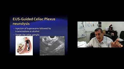 'Looking Beyond the Lumen: Update on Indications for Endoscopic Ultrasound', by Dr. BouHaidar