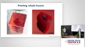 3D Printing of Personalized Thick and Perfusable Cardiac Patches and Hearts
