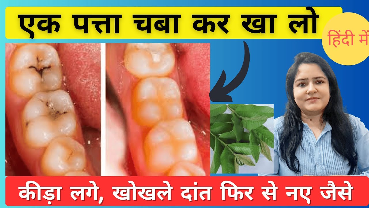 दांतों में दर्द और कीड़े का इलाज Treatment of tooth decay