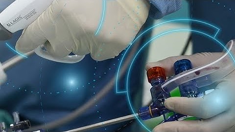 LAGIS Suction Irrigation System