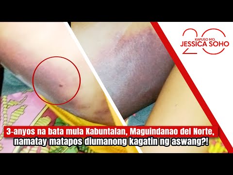 3-anyos na bata, namatay matapos diumanong kagatin ng aswang?! | Kapuso Mo, Jessica Soho